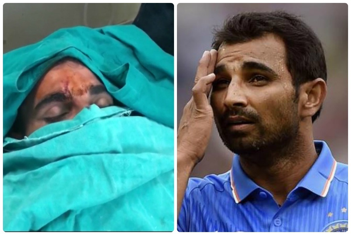 Mohammed Shami injured in road accident, receives stitches  Mohammed Shami injured in road accident, receives stitches